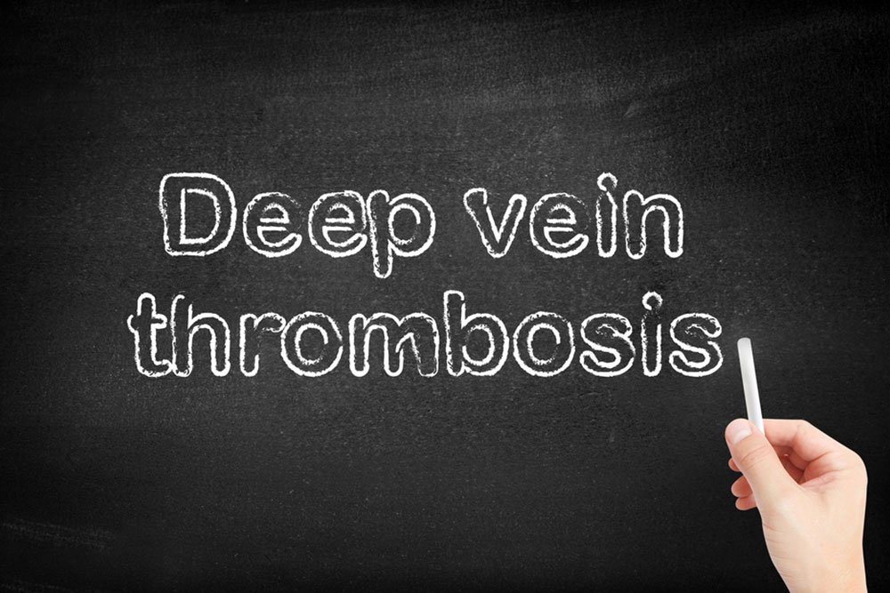 Complete Overview of Deep Vein Thrombosis: Causes, Symptoms, Preventive Measures, and Treatments