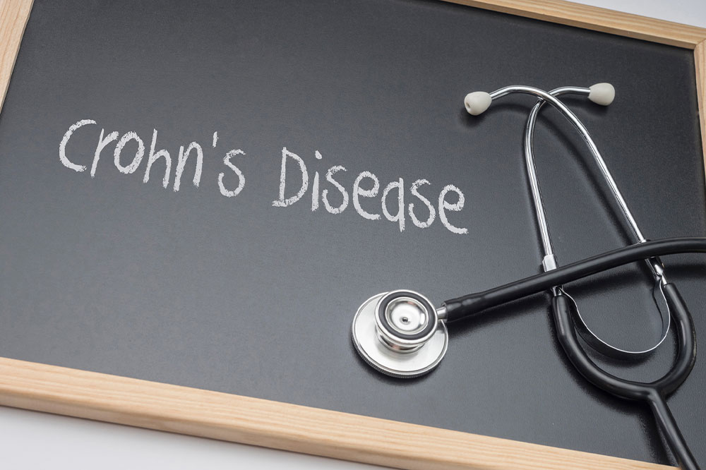 Comprehensive Guide to Crohn's Disease: Symptoms, Types, and Effective Management Strategies