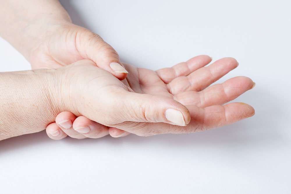 Understanding and Managing Synovial Giant Cell Tumor