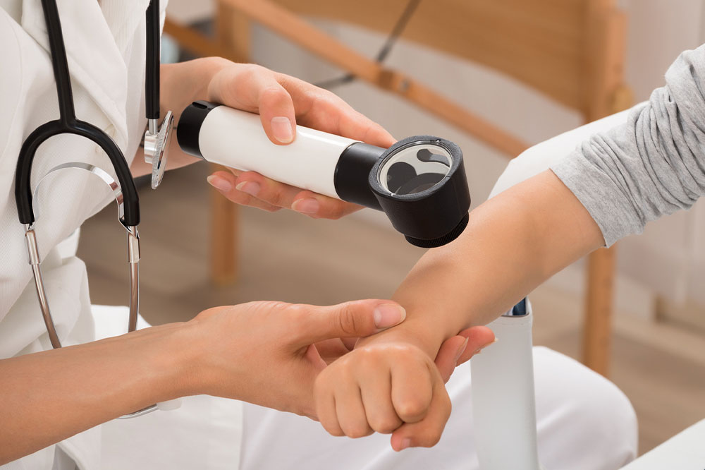 Effective Remedies and Skincare for Eczema Relief