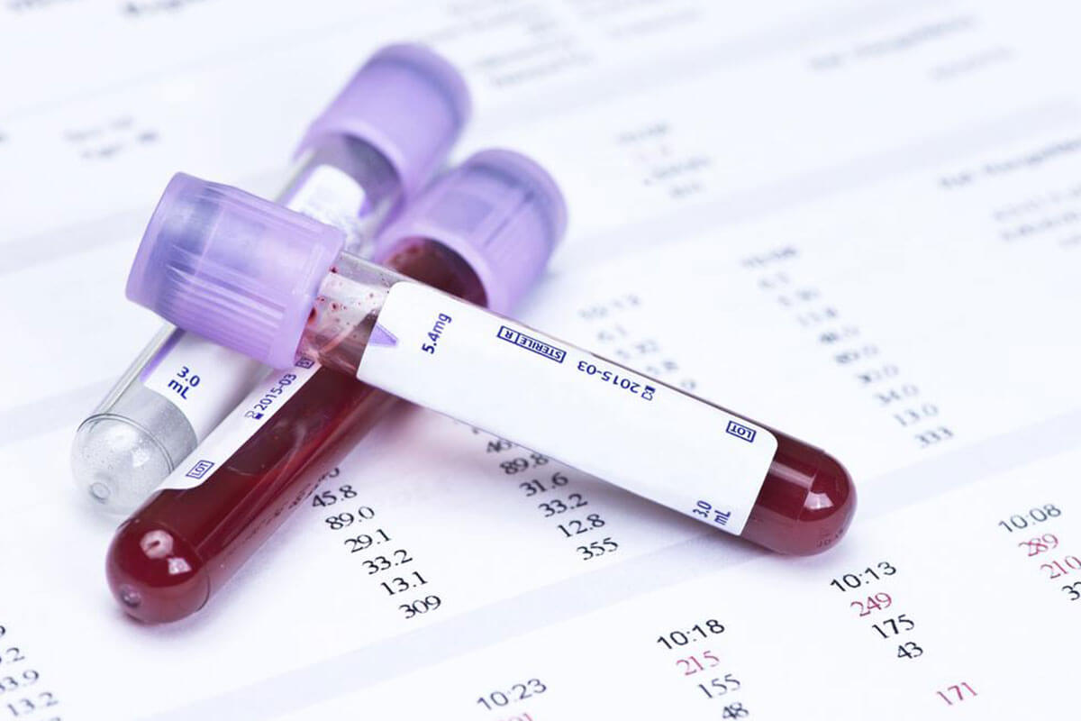 Recognizing Hemophilia Signs: When to Seek Medical Care