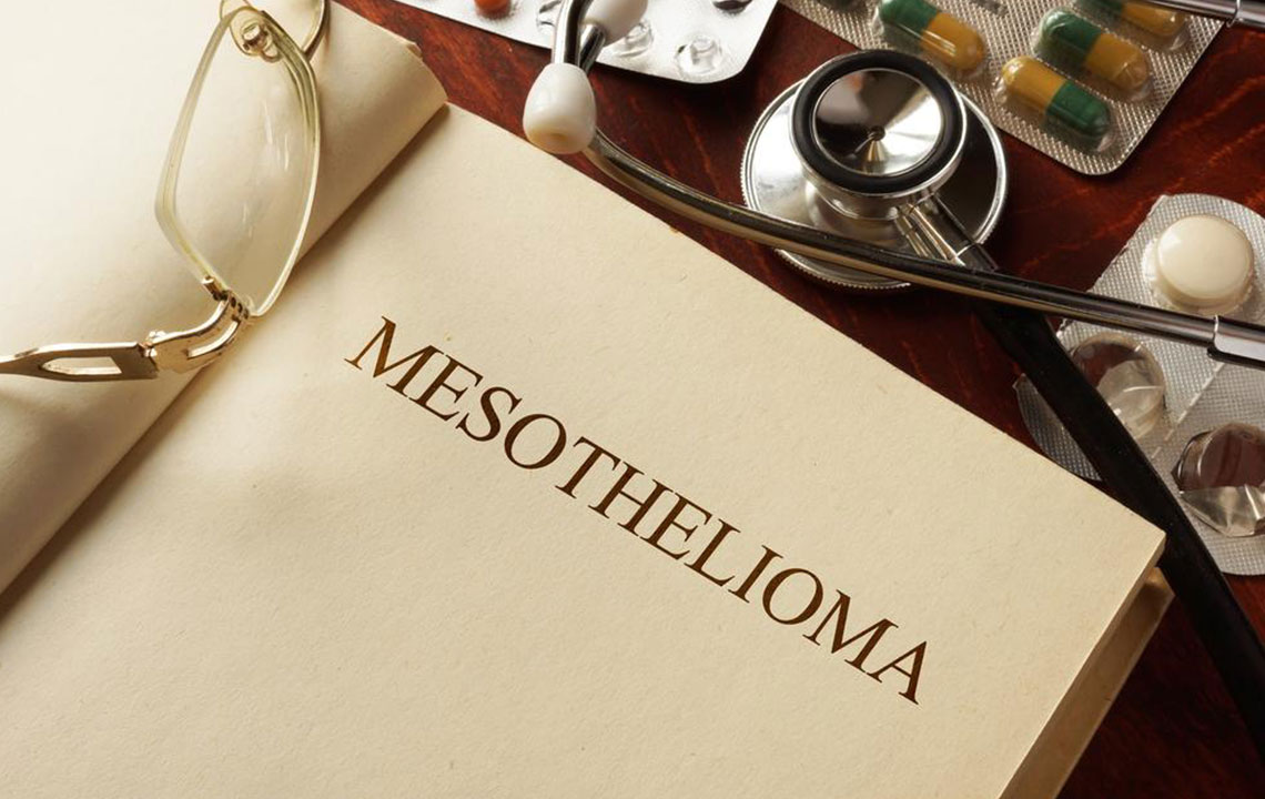 A Comprehensive Guide to Mesothelioma: Causes, Symptoms, and Treatment Options