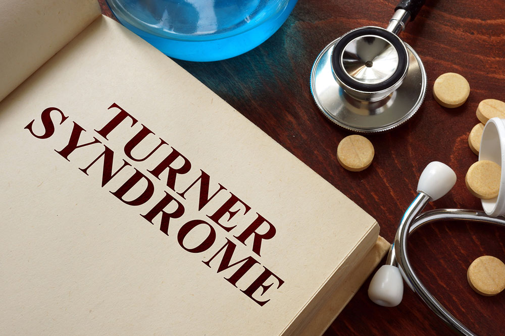 Understanding Turner Syndrome: Causes, Signs, and Management Strategies