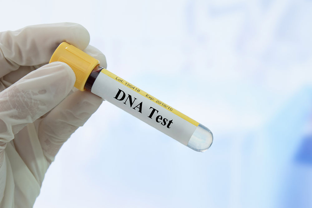Essential Insights Before Undergoing a DNA Test
