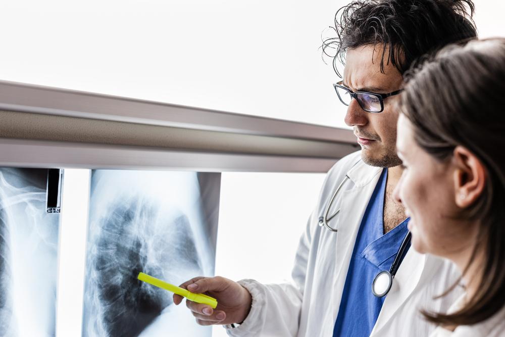Comprehensive Guide to Lung Cancer: Risks, Symptoms, and Treatment Options
