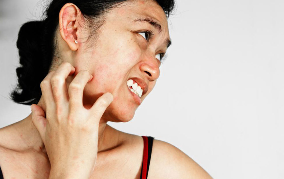 Comprehensive Guide to Common Skin Rashes: Types, Symptoms, and Treatments