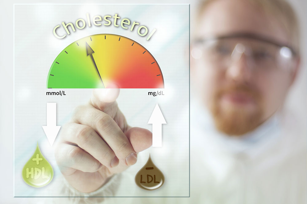 Understanding and Managing Elevated Blood Cholesterol Levels