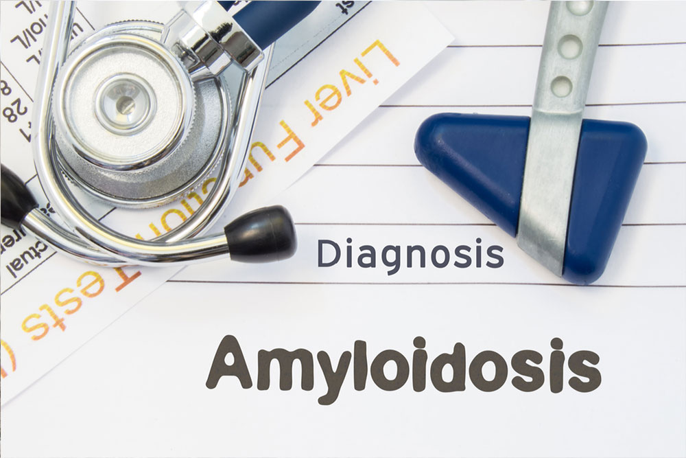 Natural Strategies for Managing Amyloidosis Symptoms