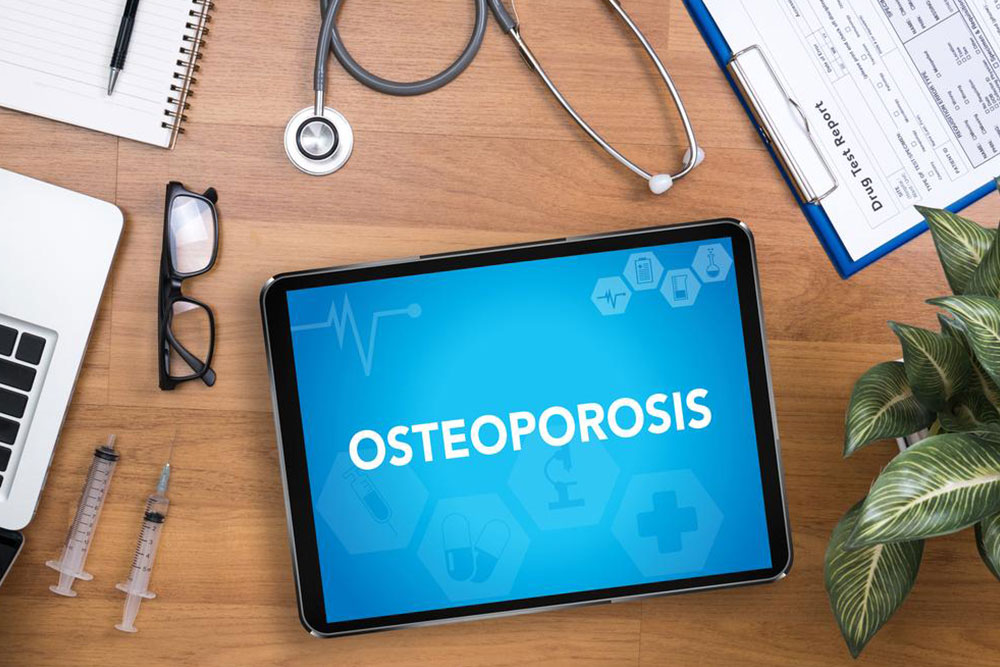 Understanding Osteoporosis: Causes, Symptoms, and Prevention