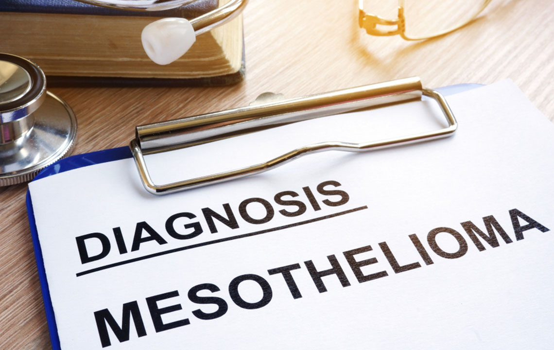 Top Strategies for Managing Mesothelioma Effectively