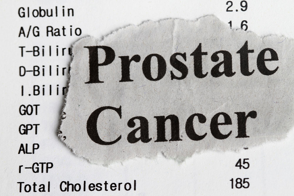 Comprehensive Guide to Prostate Cancer: Stages, Diagnosis, and Treatment Options