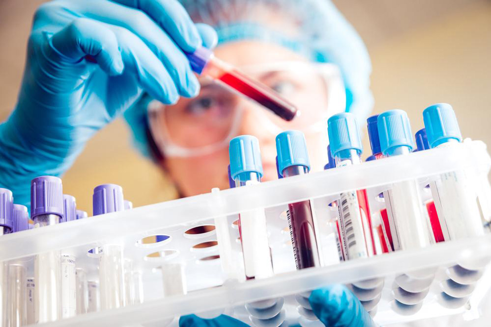 Understanding Blood Thinners and Their Role in Preventing Clots