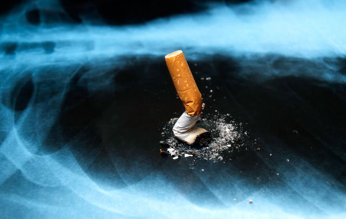 Understanding the Main Types of Lung Cancer