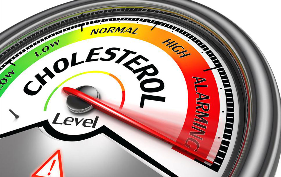 Comprehensive Guide to Managing and Lowering Your Cholesterol Levels for Better Heart Health