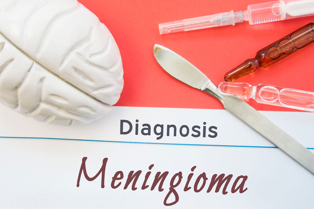 Understanding Meningioma: Symptoms, Causes, Diagnosis, and Treatment