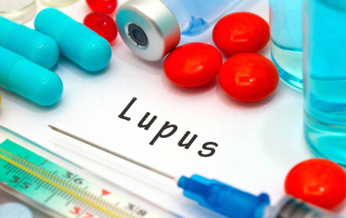 Recognizing the 8 Early Indicators of Lupus