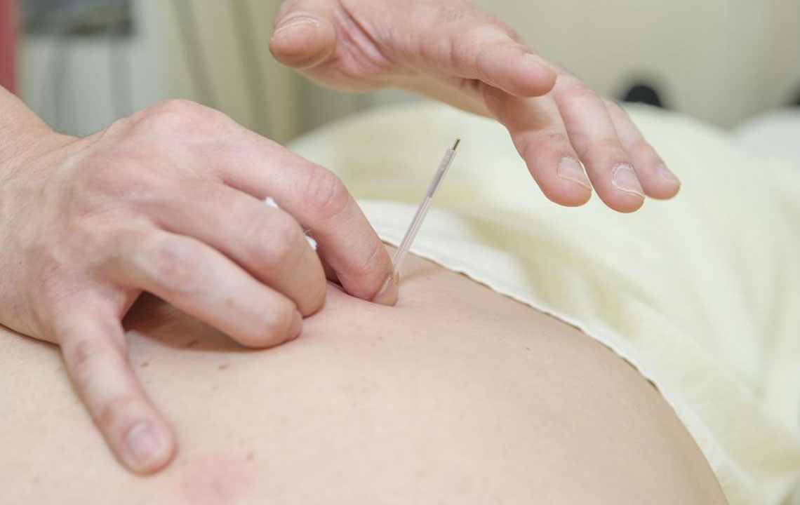 Comprehensive Guide to 9 Proven Treatments for Sciatic Nerve Pain Relief