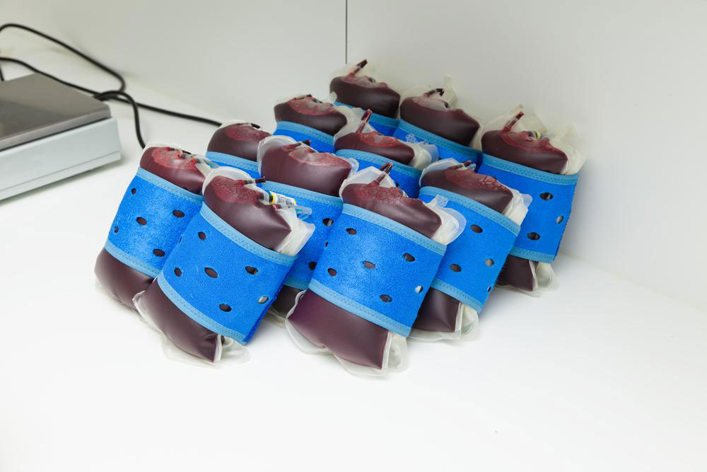 Choosing the Best Cord Blood Banking Service for Your Family