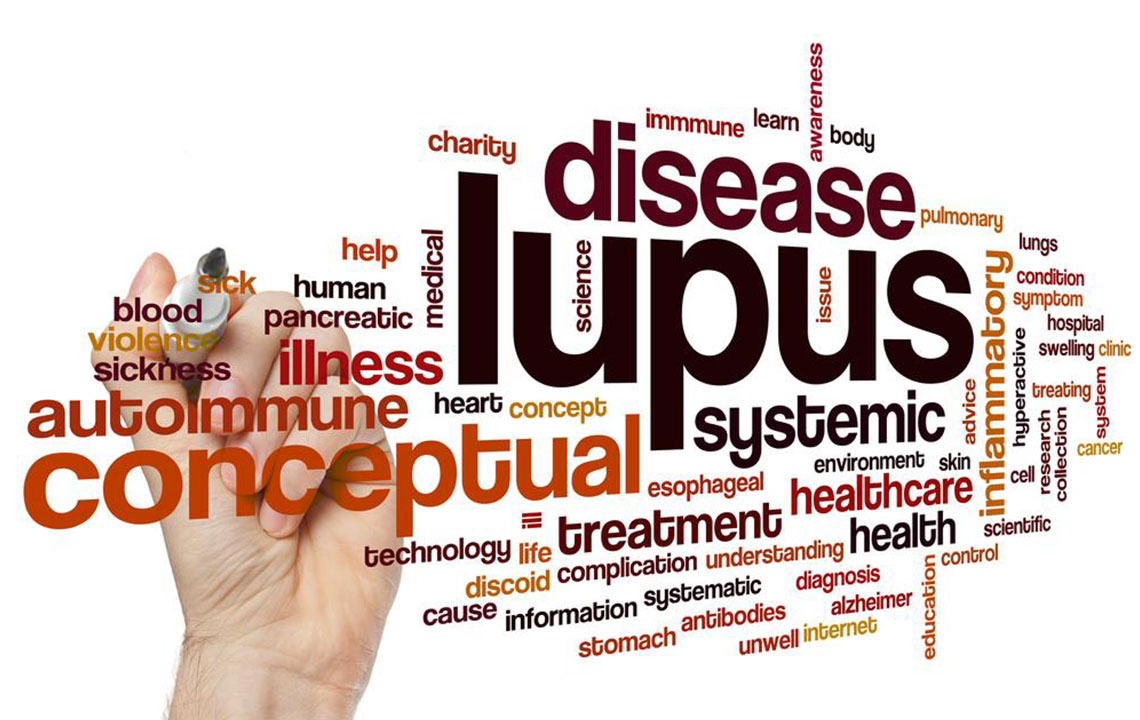 Recognizing Key Signs of Lupus in Women