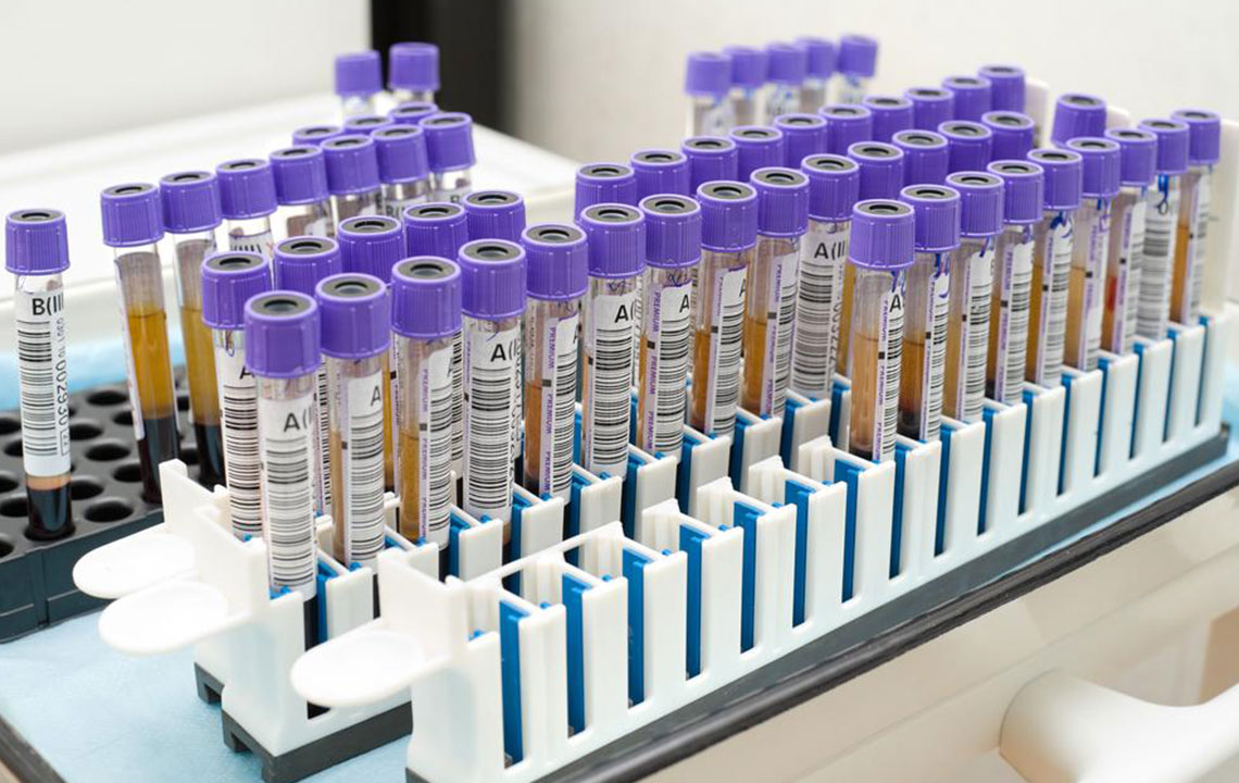 Comprehensive Guide to ELISA Testing and Kits