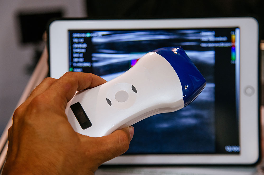 The Benefits of Portable Ultrasound Technology in Modern Healthcare