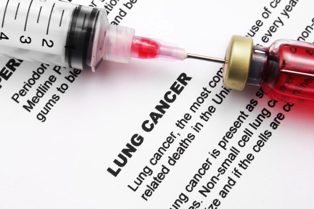 Managing Side Effects of Lung Cancer Treatments: Practical Remedies