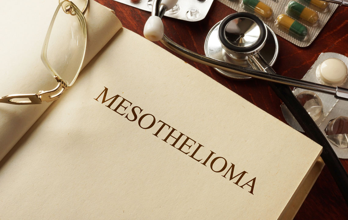 Comprehensive Guide to Mesothelioma: Origins, Variants, and Early Warning Signals