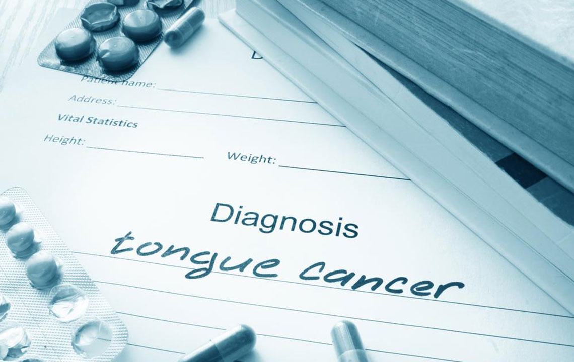 Warning Signs of Tongue Cancer You Should Recognize