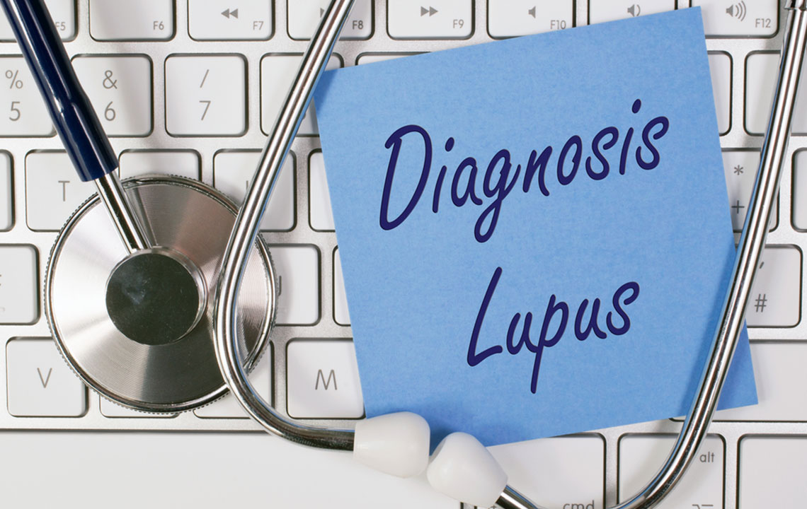 Recognizing Early Signs of Lupus: Key Symptoms to Identify