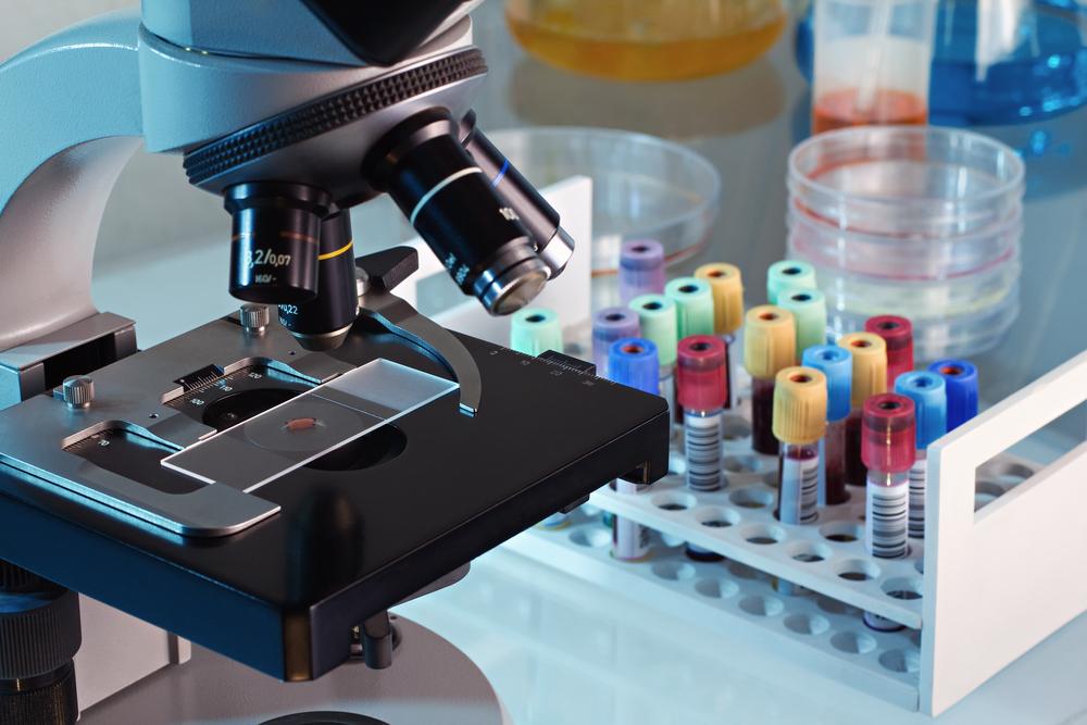 Guide to Using an AncestryDNA Test Kit for Your Heritage Research
