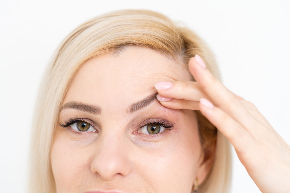 Effective Treatments for Sagging Eyelids
