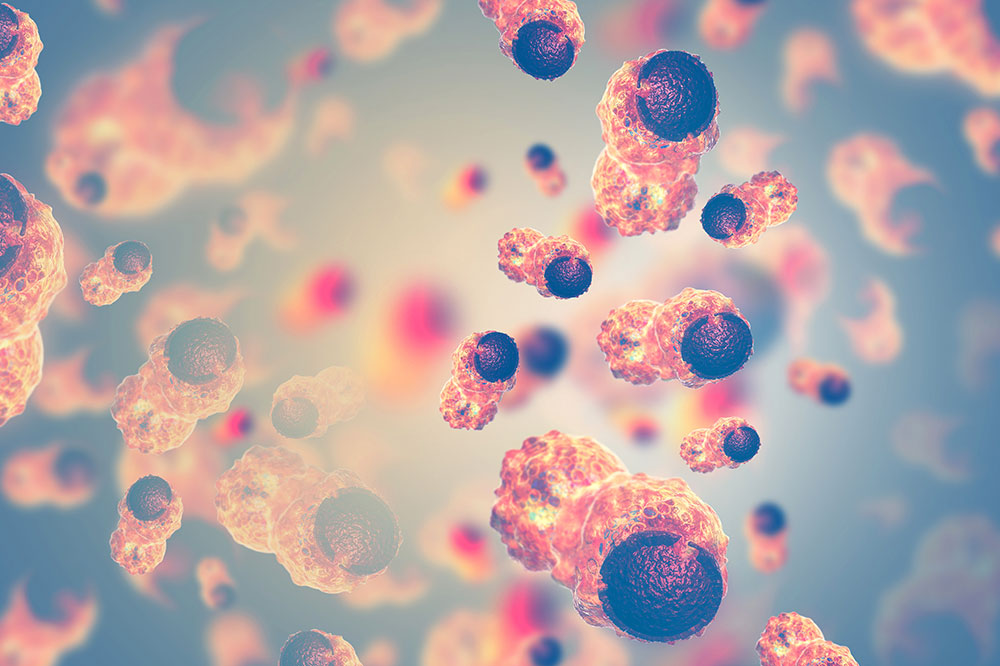 Comprehending Cancer Relapse and Its Implications