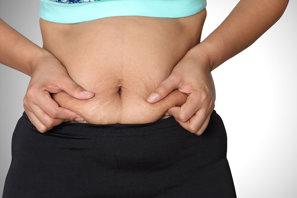 Effective Strategies to Reduce Stubborn Abdominal Fat