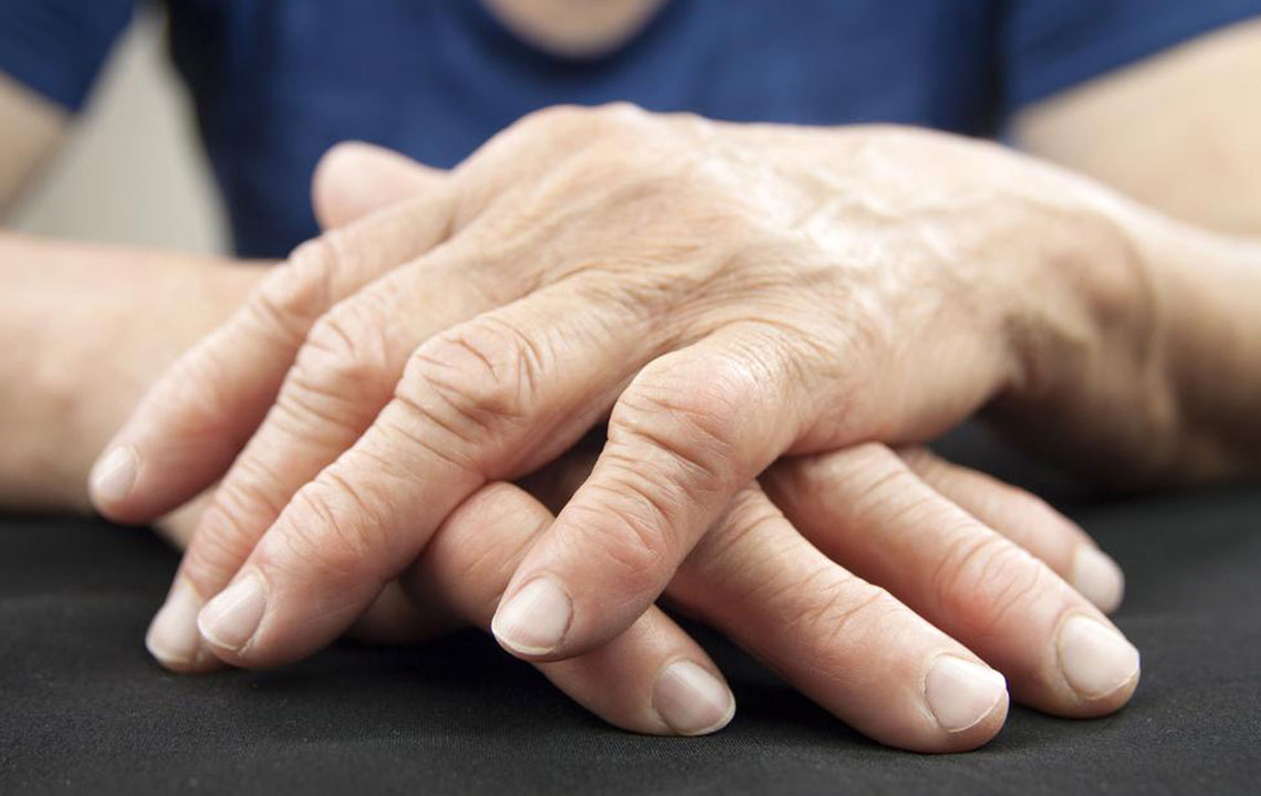 Understanding Rheumatoid Arthritis: Symptoms, Causes, and Natural Treatments
