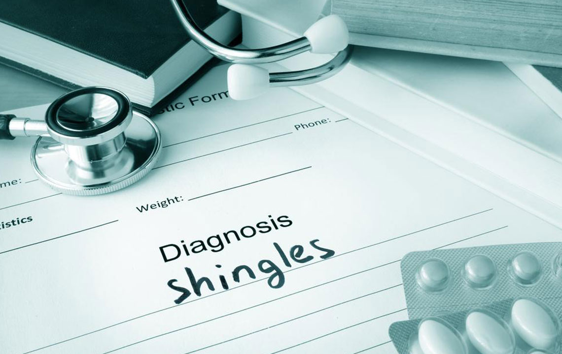 Effective Approaches to Managing Shingles: Medications and Natural Remedies
