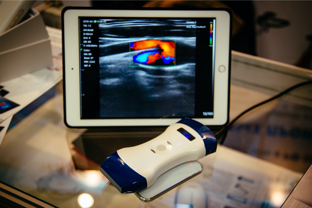 Guide to Portable Ultrasound Devices: Types and Top Picks