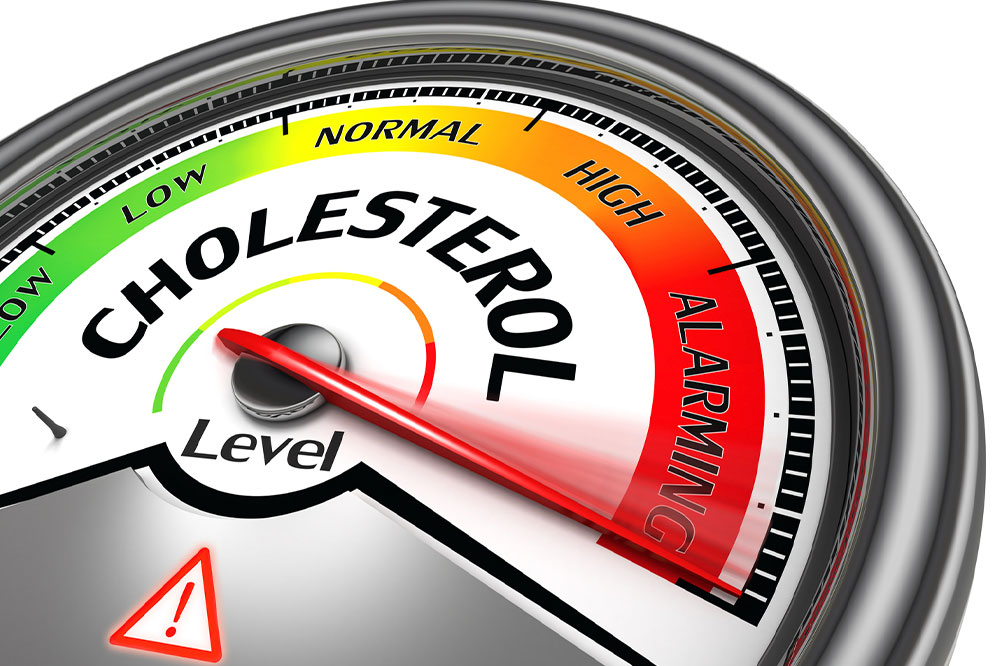 Essential Insights into Managing Cholesterol Levels