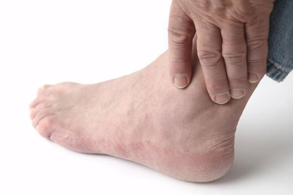 Understanding and Managing Causes of Tingling Sensations