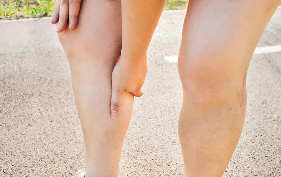 How Cholesterol Levels Influence Leg Health and Mobility