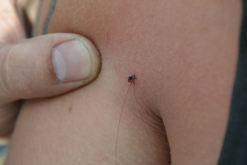Guide to Recognizing Different Types of Spider Bites