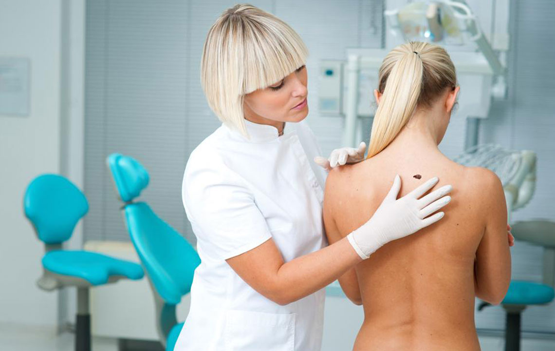 Comprehensive Guide to Melanoma: Causes, Early Warning Signs, and Prevention Strategies