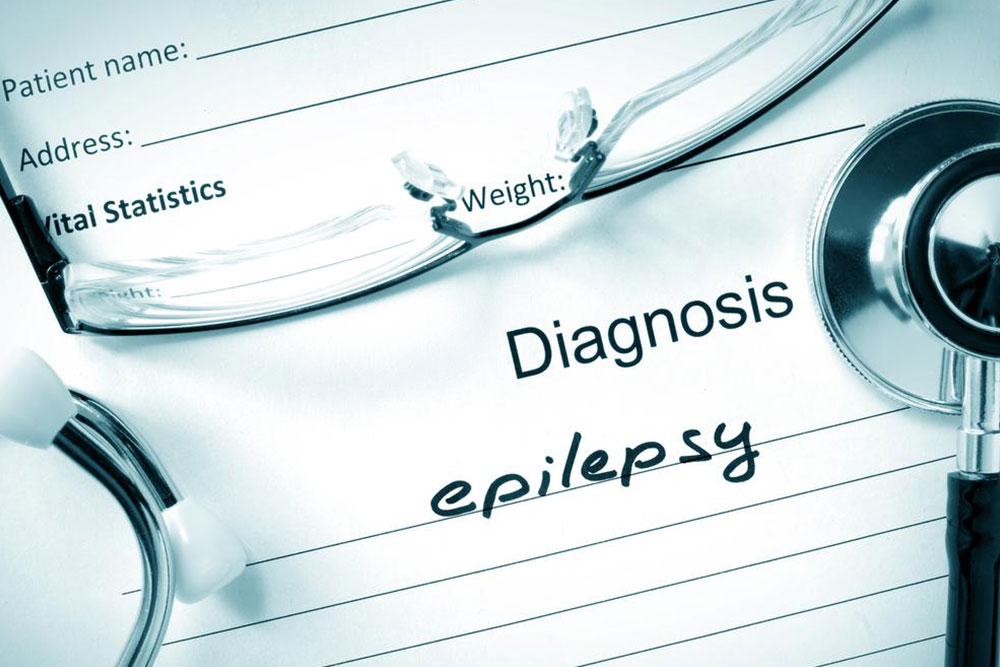 Comprehensive Guide to Understanding Epilepsy