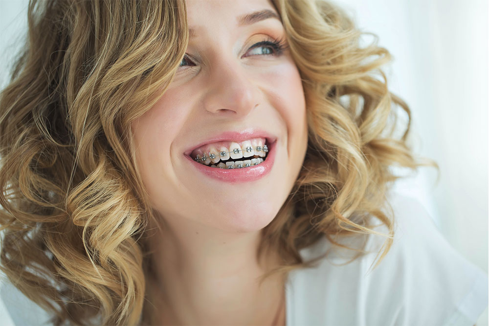 Comprehensive Adult Orthodontic Treatment Guide