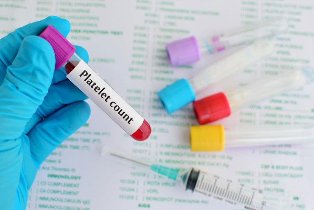 Understanding Thrombocytopenia: Causes and Warning Signs