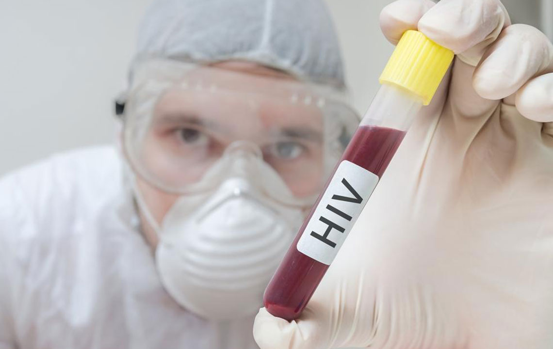 Effective Strategies for HIV and AIDS Diagnosis and Management