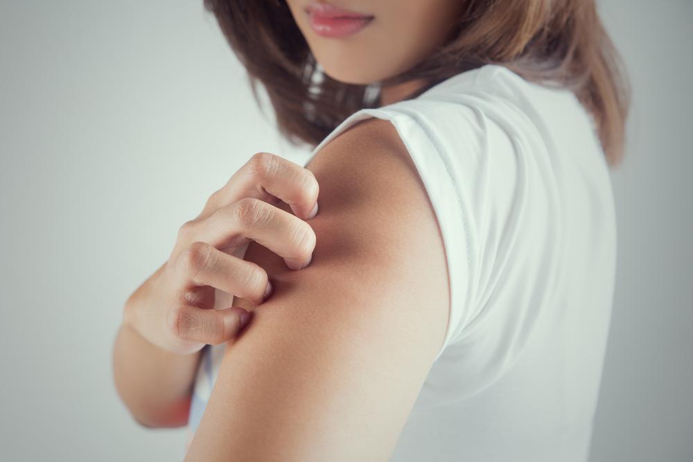 Top 10 Causes of Hives and How to Prevent Them