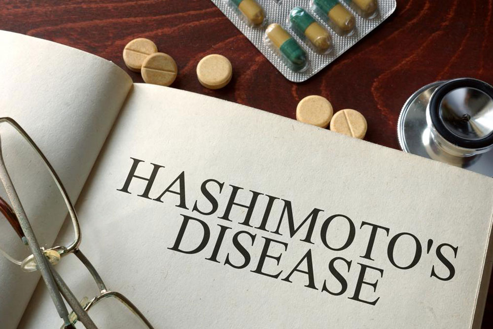Understanding Hashimoto's Thyroiditis: Causes and Early Signs