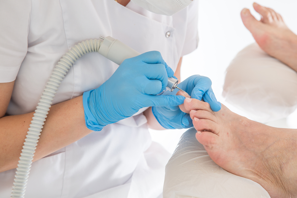 Comprehensive Strategies to Treat and Prevent Toenail and Fingernail Fungal Infections