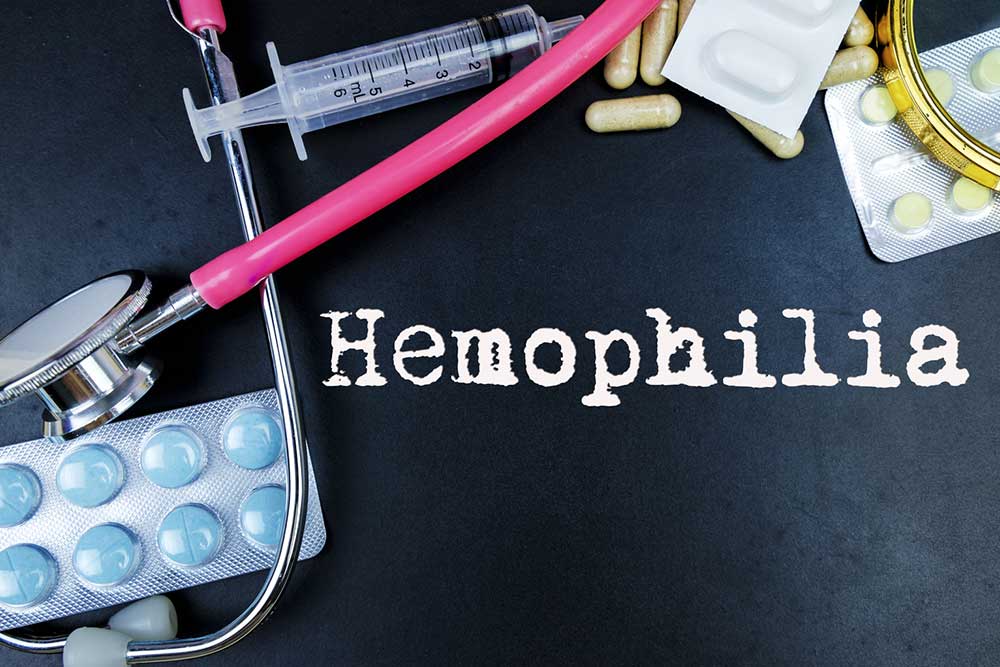 Effective Strategies for Managing Hemophilia