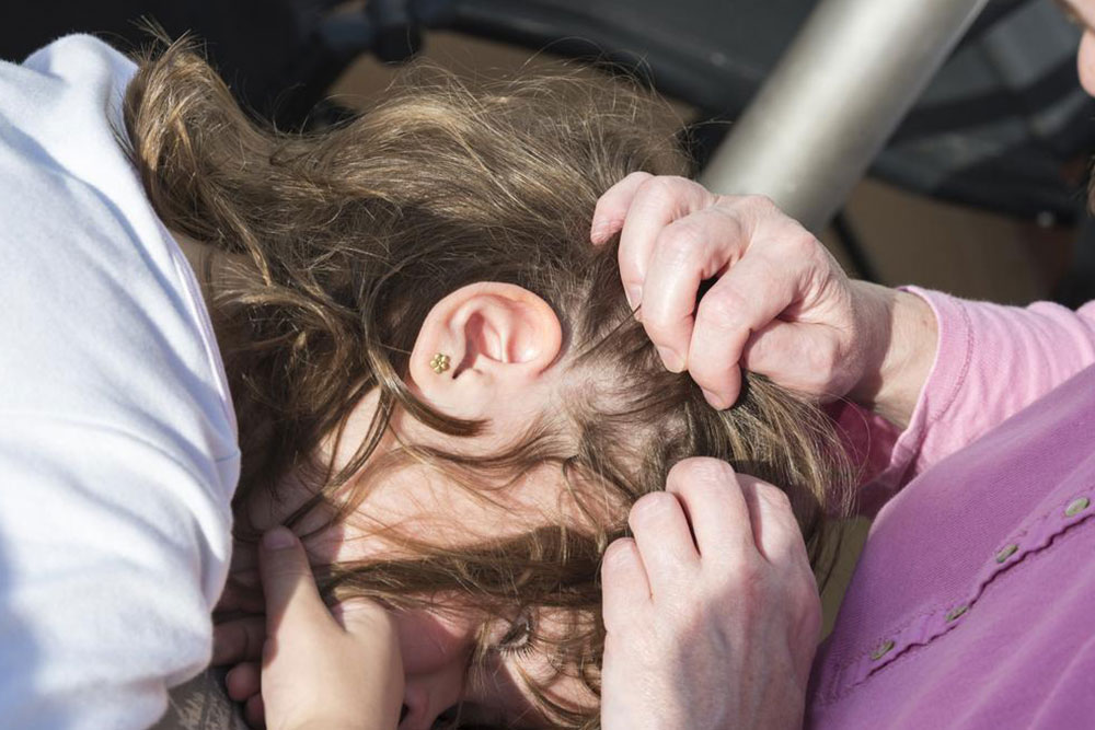 Effective Home Strategies to Eliminate Head Lice